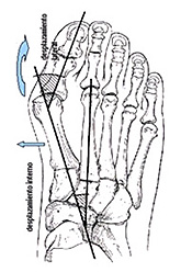 articulacion2.jpg