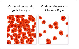 anemia2.jpg